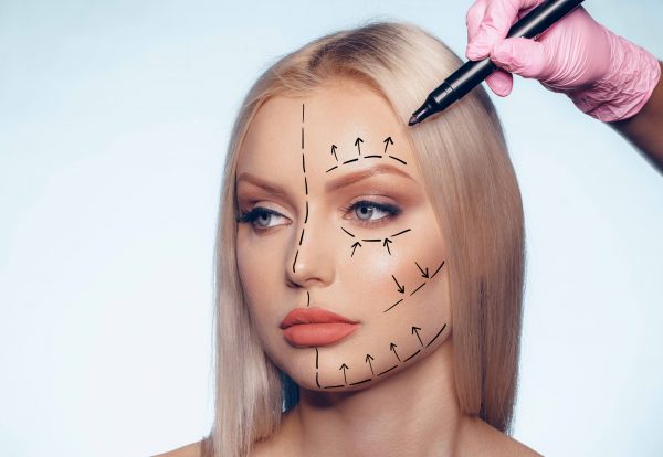beautiful-blonde-woman-with-markings-plastic-surgery-her-face