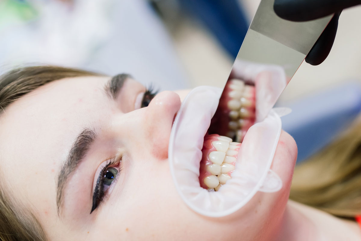 Diş eti Hastalıkları - Periodontoloji